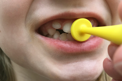 ¿Cómo estimular el cierre labial con el ejercicio del botón?
